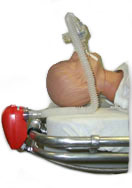 Intubation_picture